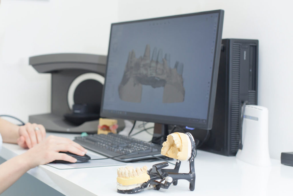 Dental 3D printing